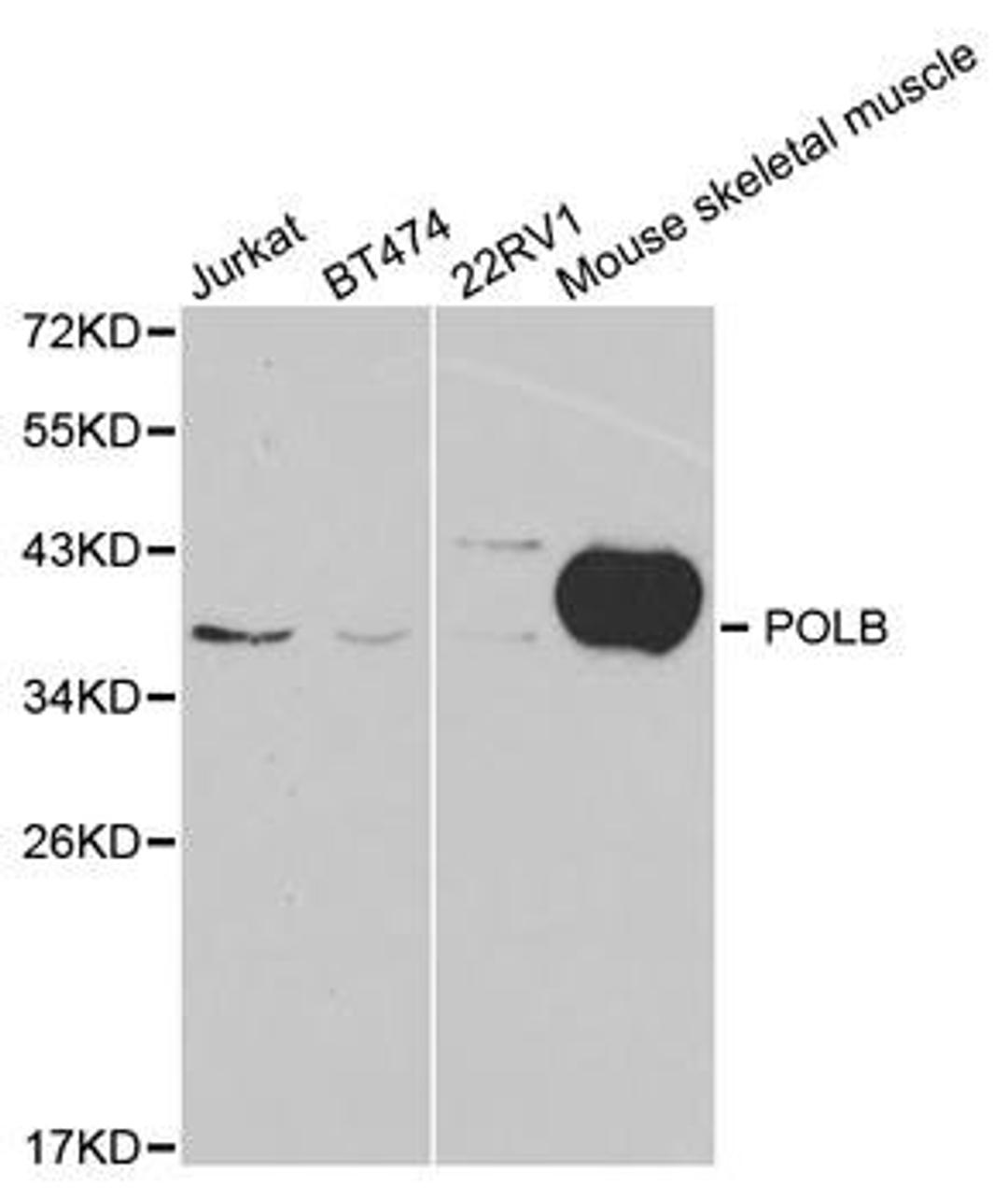 Western blot analysis of extracts of various cell lines using POLB antibody