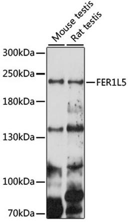 Western blot - FER1L5 antibody (A15926)