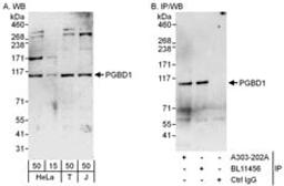 Detection of human PGBD1 by western blot and immunoprecipitation.