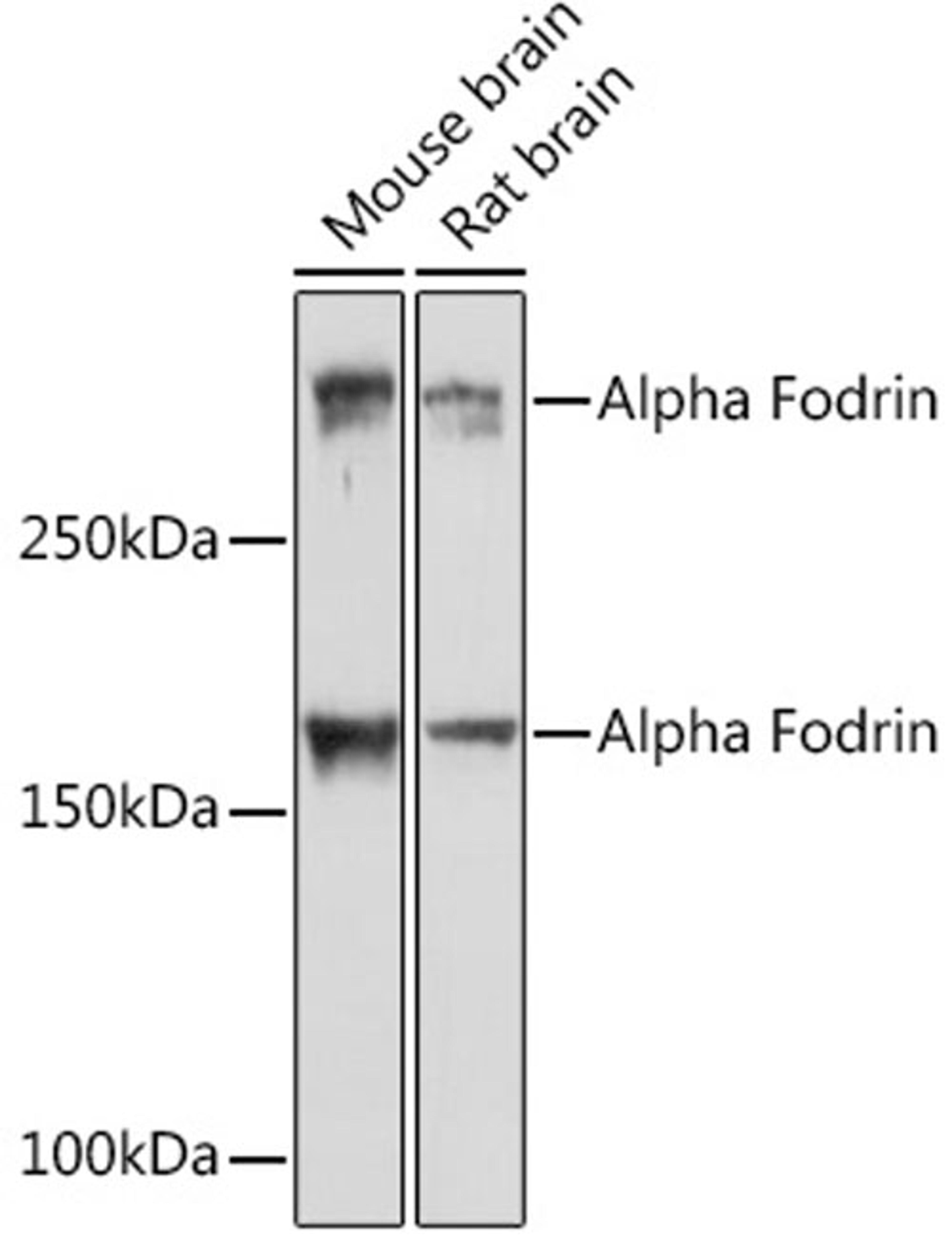 Western blot - Alpha Fodrin Rabbit mAb (A2418)