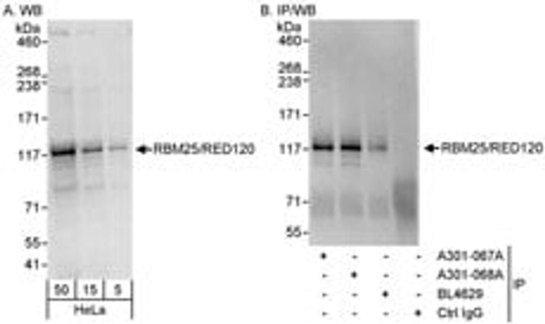 Detection of human RBM25/RED120 by western blot and immunoprecipitation.