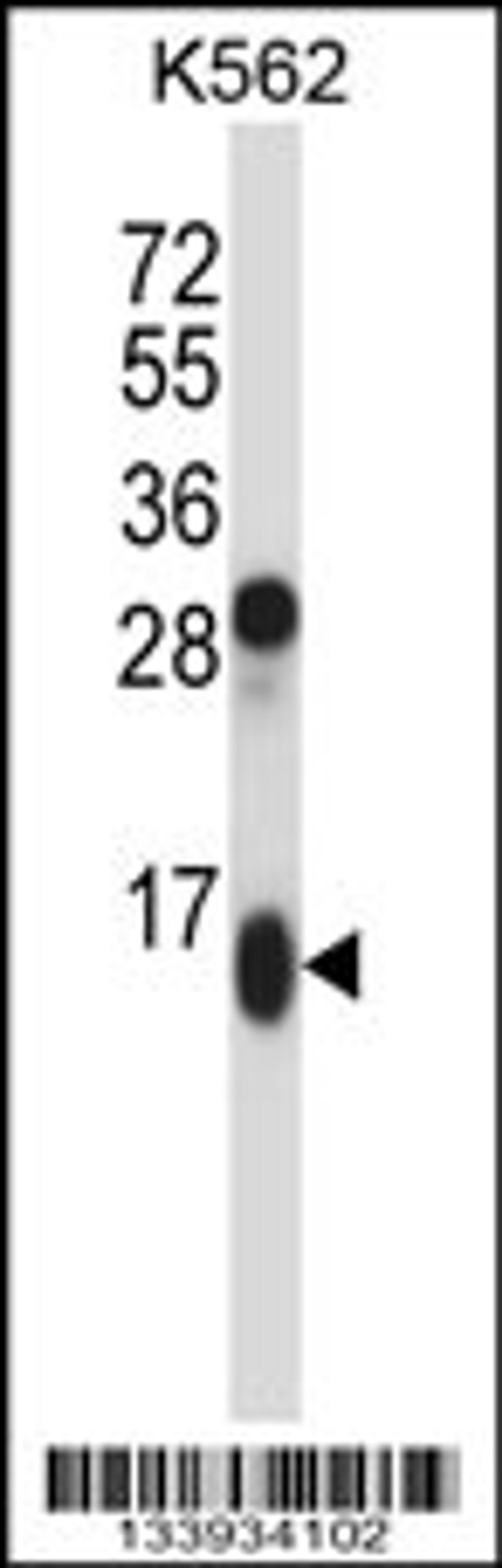 Western blot analysis in K562 cell line lysates (35ug/lane).