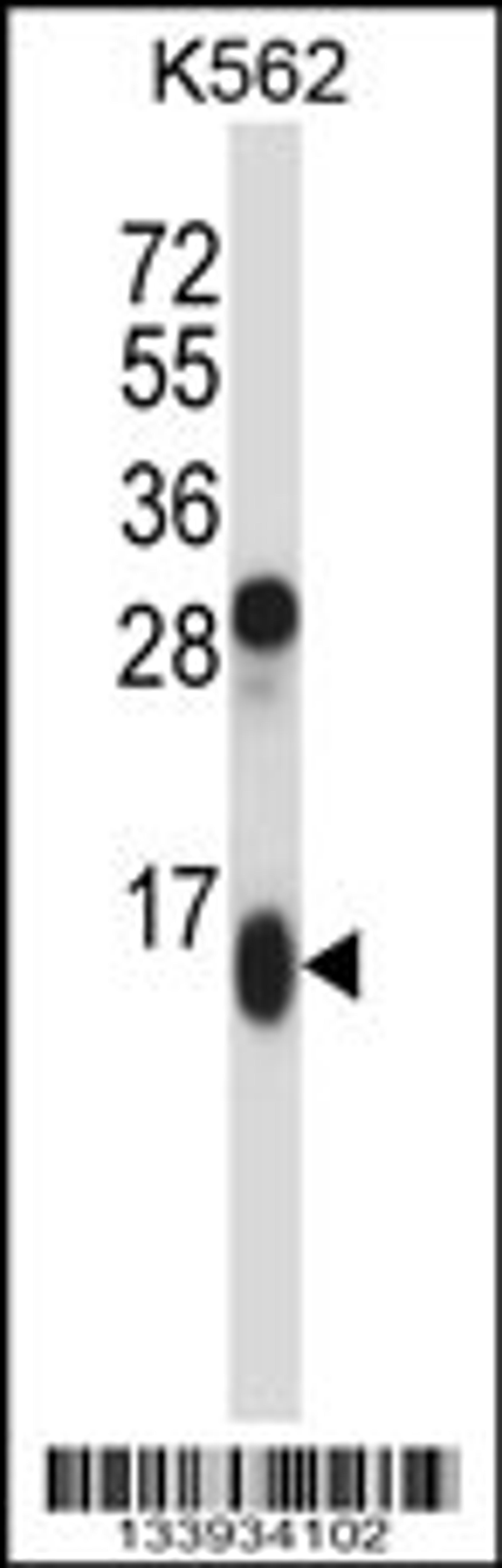 Western blot analysis in K562 cell line lysates (35ug/lane).