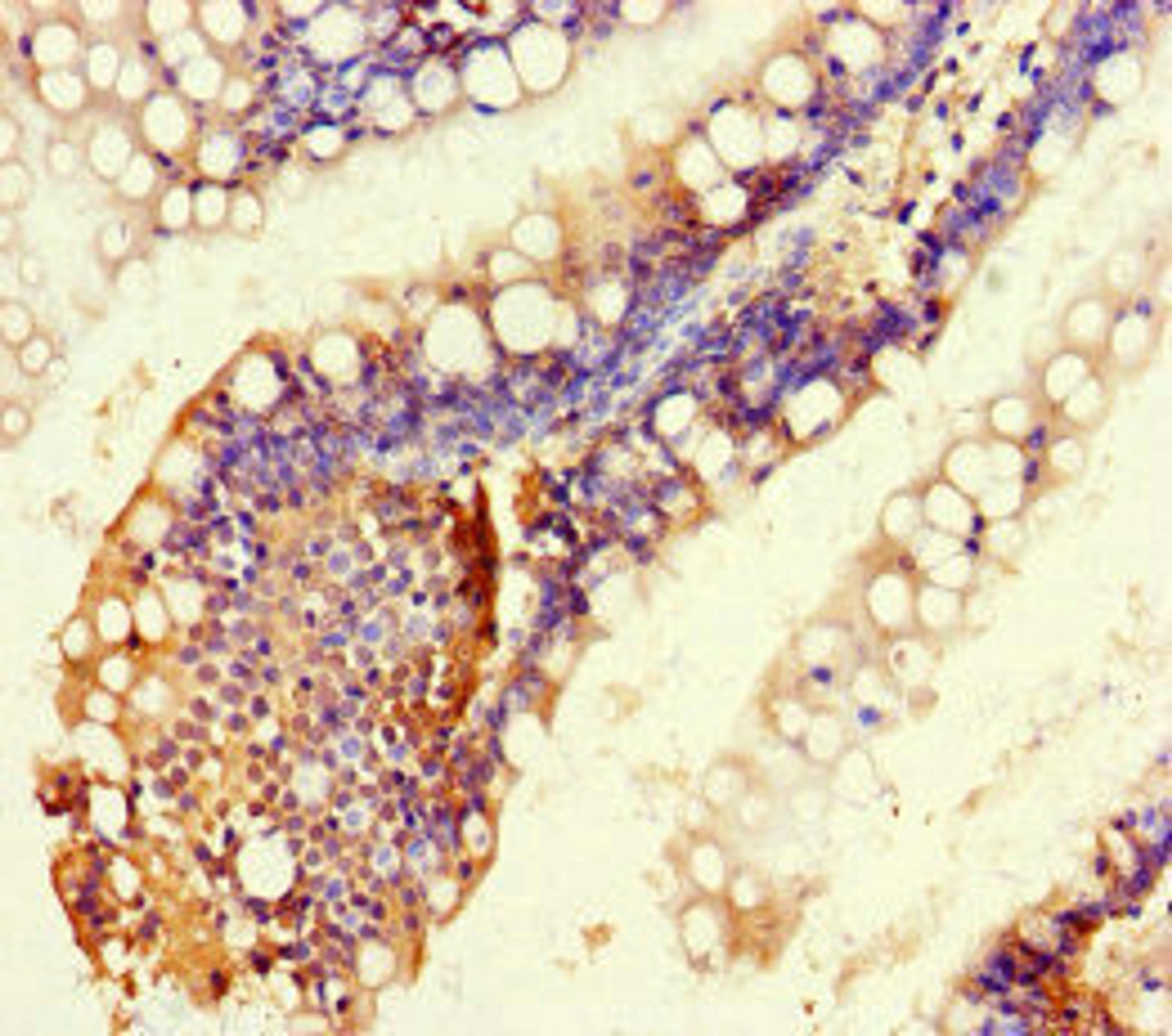 Immunohistochemistry of paraffin-embedded human small intestine tissue using CSB-PA020563LA01HU at dilution of 1:100