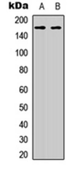 Western blot analysis of HeLa (Lane 1), HEK293T (Lane 2) whole cell lysates using AS160 antibody