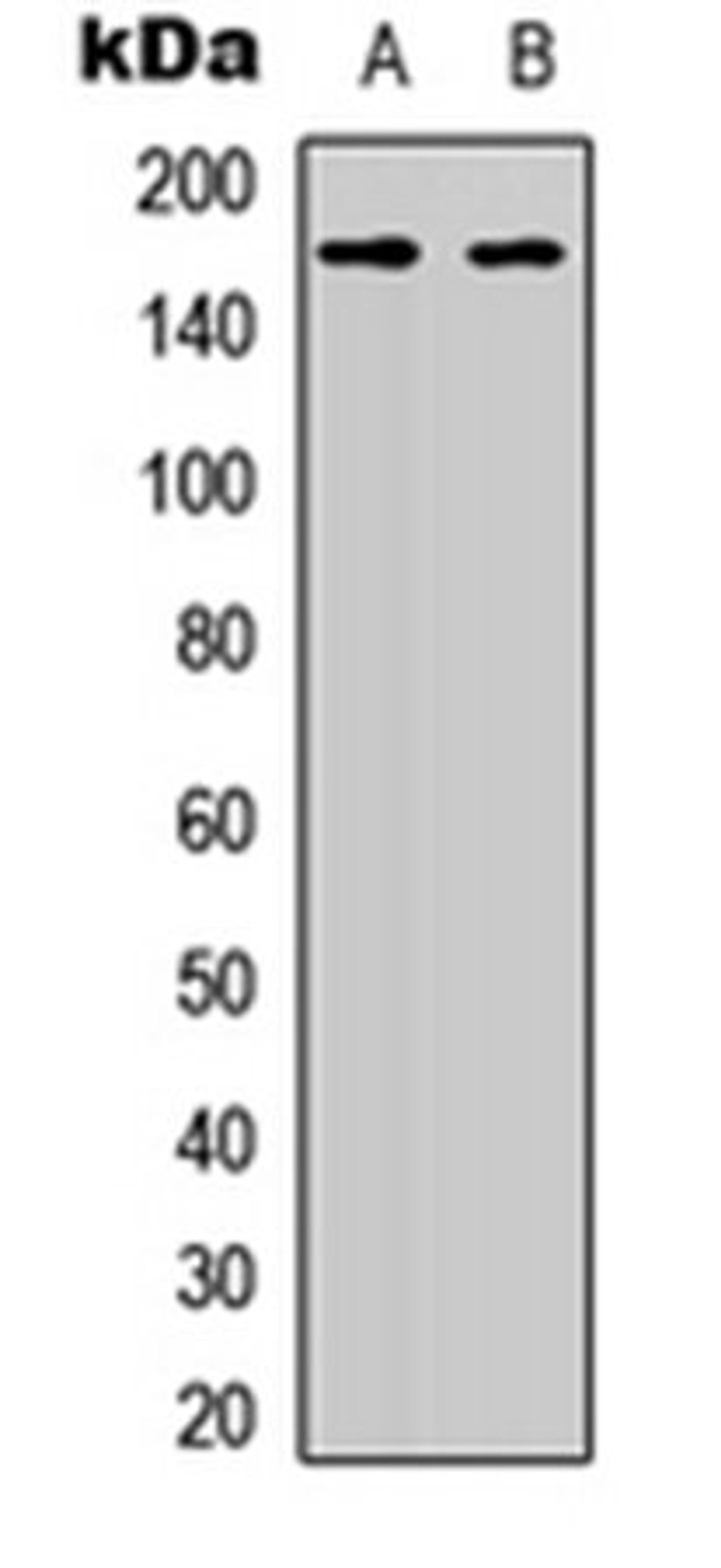 Western blot analysis of HeLa (Lane 1), HEK293T (Lane 2) whole cell lysates using AS160 antibody