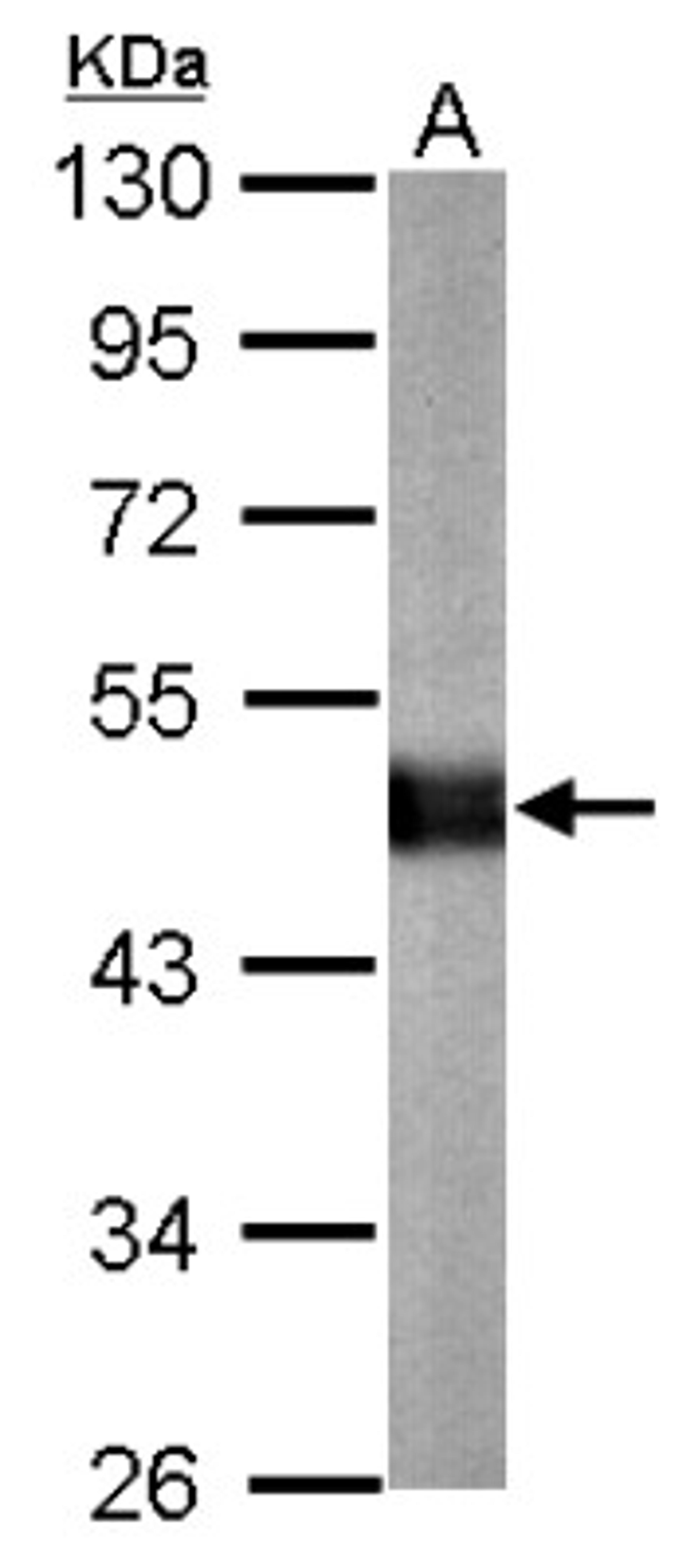 Western Blot: Carboxypeptidase E Antibody [NBP2-15699] - Sample (20 ug of whole cell lysate) A: mouse brain 10% SDS PAGE gel, diluted at 1:10000.