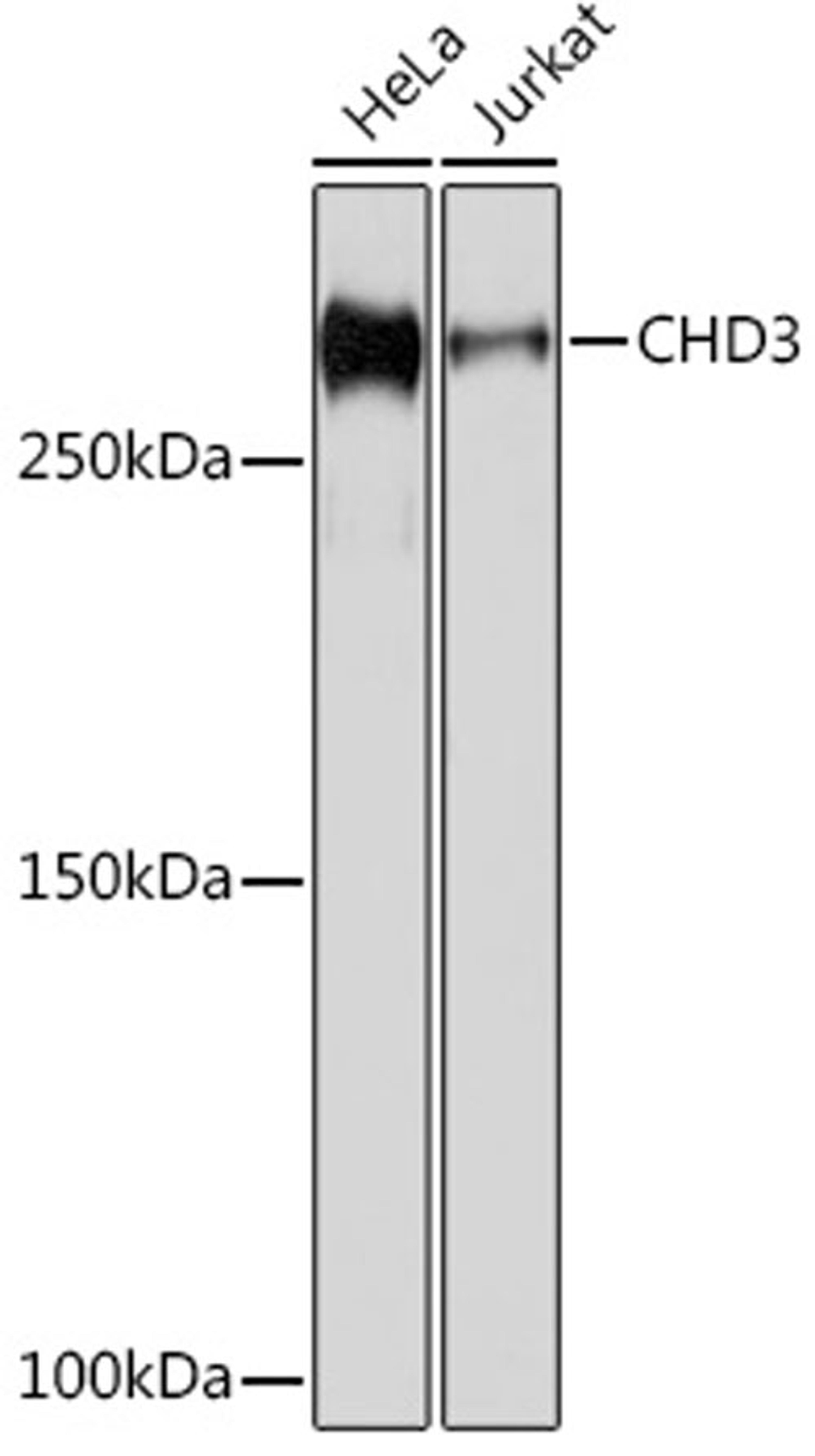 Western blot - CHD3 Rabbit mAb (A6118)