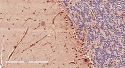 Immunohistochemical staining of  Human Cerebellum using DCX antibody