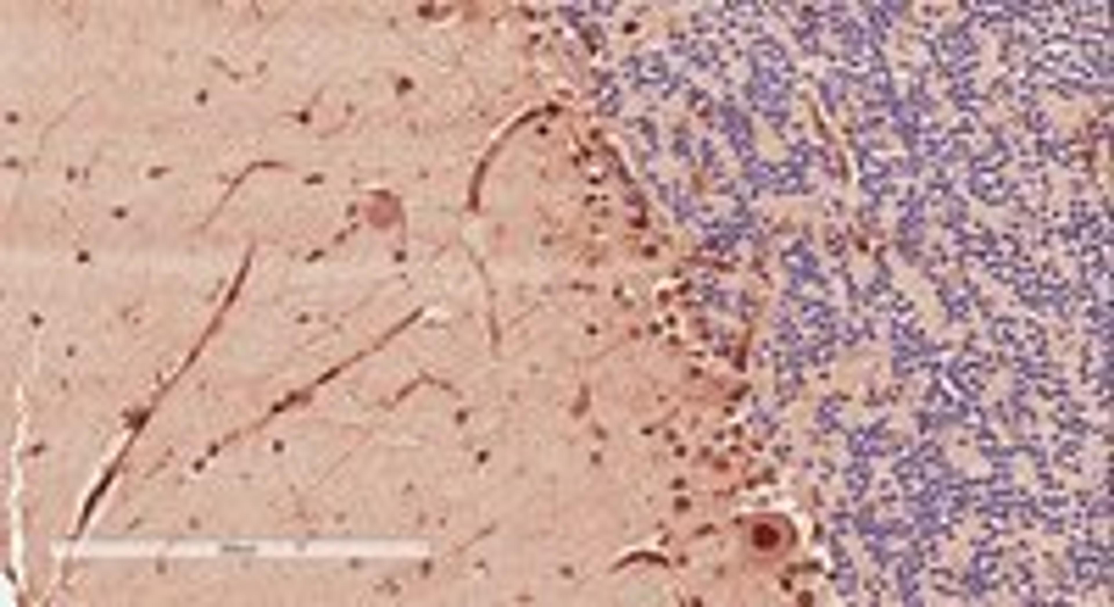 Immunohistochemical staining of  Human Cerebellum using DCX antibody