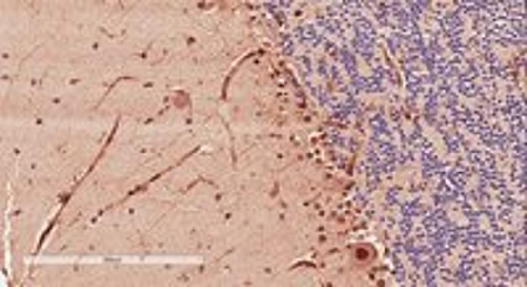 Immunohistochemical staining of Human Cerebellum using DCX antibody