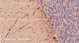 Immunohistochemical staining of Human Cerebellum using DCX antibody