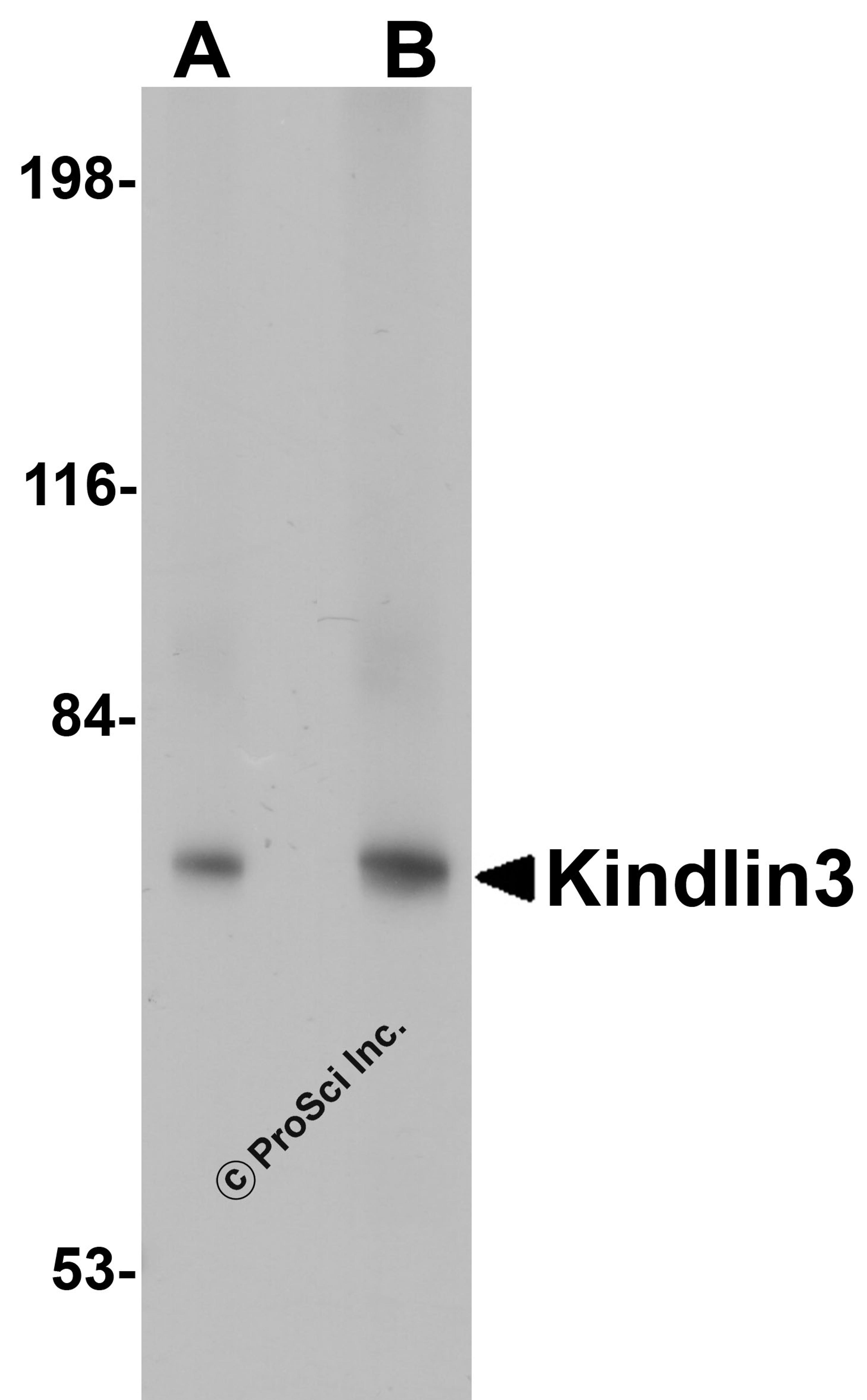 Western blot analysis of KINDLIN3 in rat spleen lysate with KINDLIN3 antibody at (A) 1 and (B) 2 μg/mL.