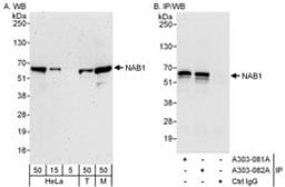 Detection of human and mouse NAB1 by western blot (h & m) and immunoprecipitation (h).