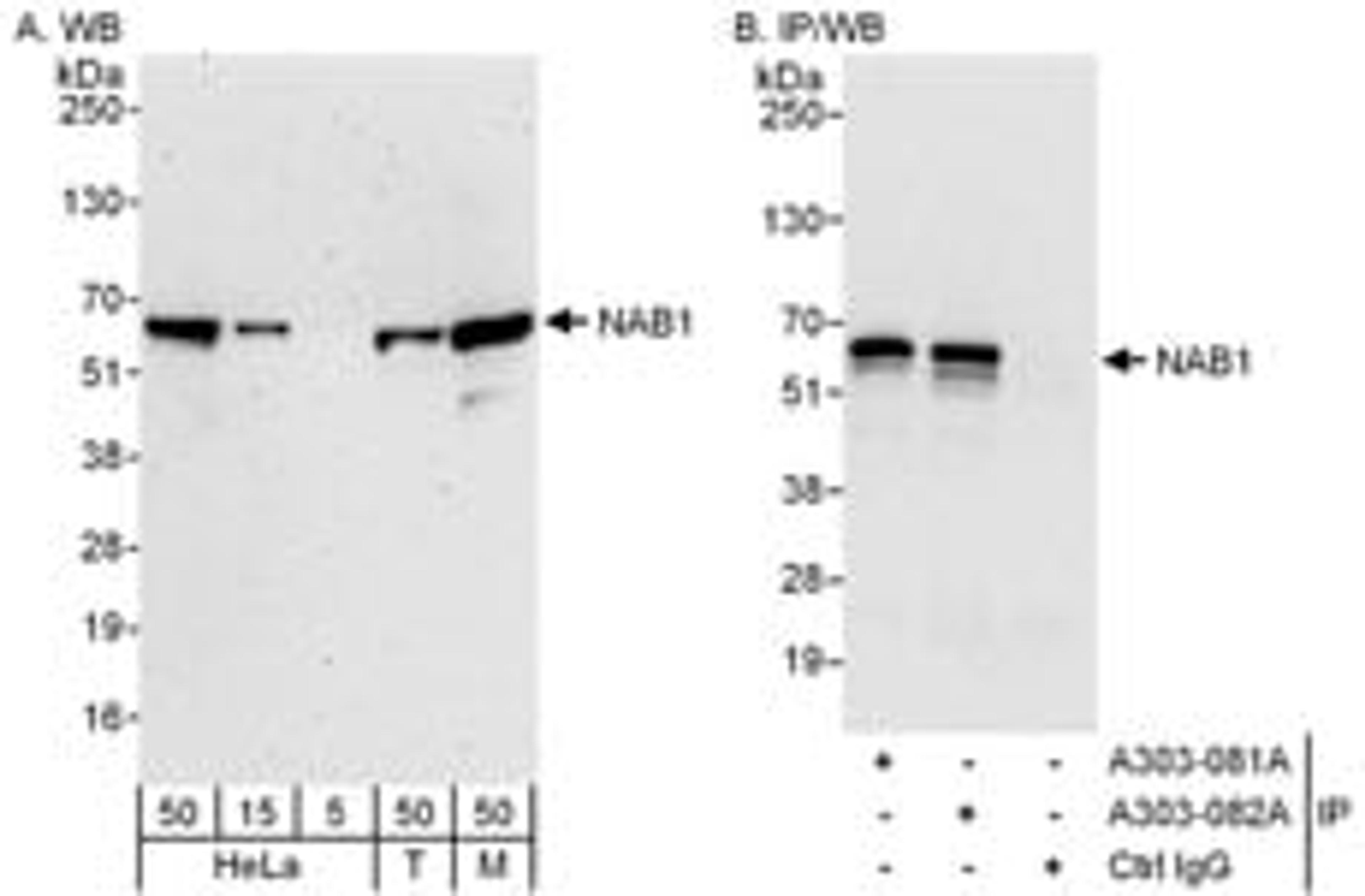 Detection of human and mouse NAB1 by western blot (h & m) and immunoprecipitation (h).