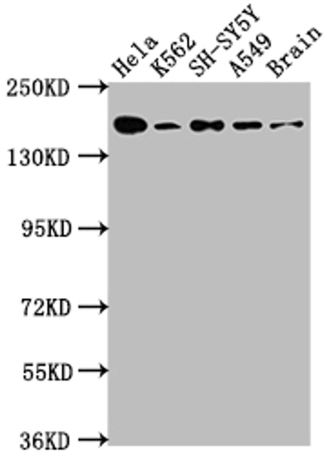 Western Blot. Positive WB detected in: Hela whole cell lysate, K562 whole cell lysate, SH-SY5Y whole cell lysate, A549 whole cell lysate, Rat Brain whole cell lysate. All lanes: APC antibody at 1:1000. Secondary. Goat polyclonal to rabbit IgG at 1/50000 dilution. Predicted band size: 312, 301, 309 kDa. Observed band size: 160 kDa. 