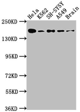 Western Blot. Positive WB detected in: Hela whole cell lysate, K562 whole cell lysate, SH-SY5Y whole cell lysate, A549 whole cell lysate, Rat Brain whole cell lysate. All lanes: APC antibody at 1:1000. Secondary. Goat polyclonal to rabbit IgG at 1/50000 dilution. Predicted band size: 312, 301, 309 kDa. Observed band size: 160 kDa. 