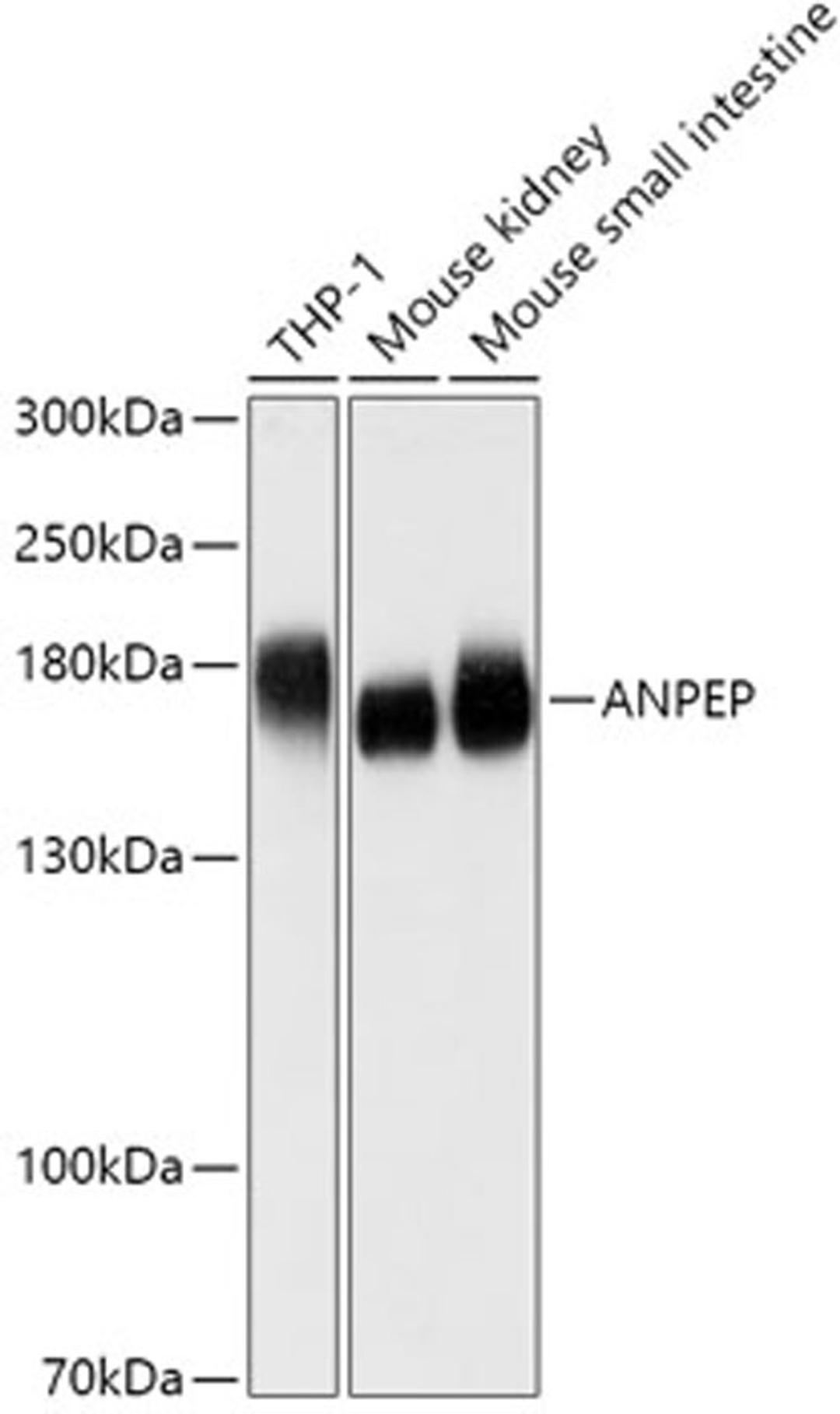 Western blot - ANPEP antibody (A5662)