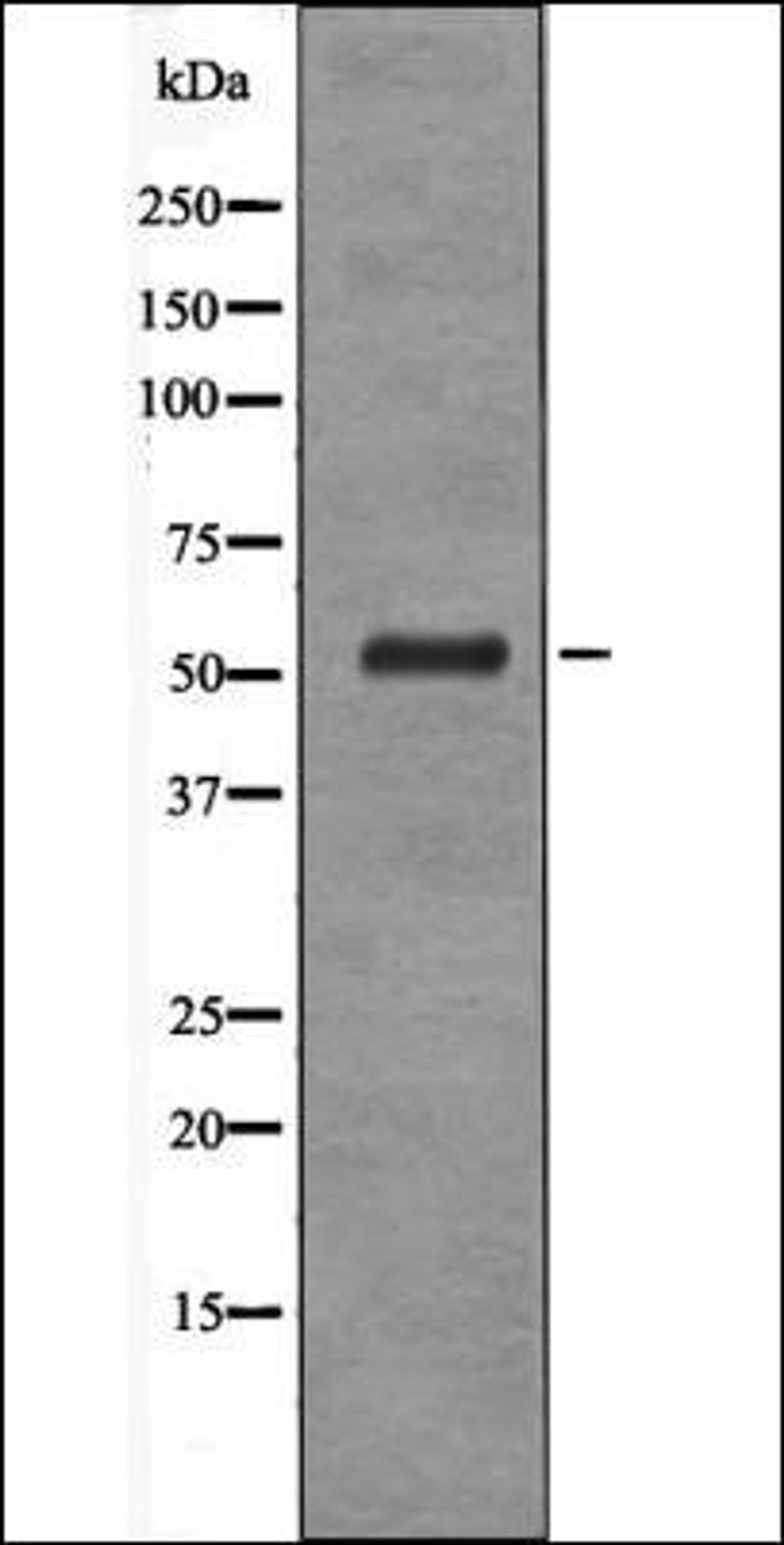 Western blot analysis of UV treated HeLa whole cell lysates using Vimentin -Phospho-Ser39- antibody