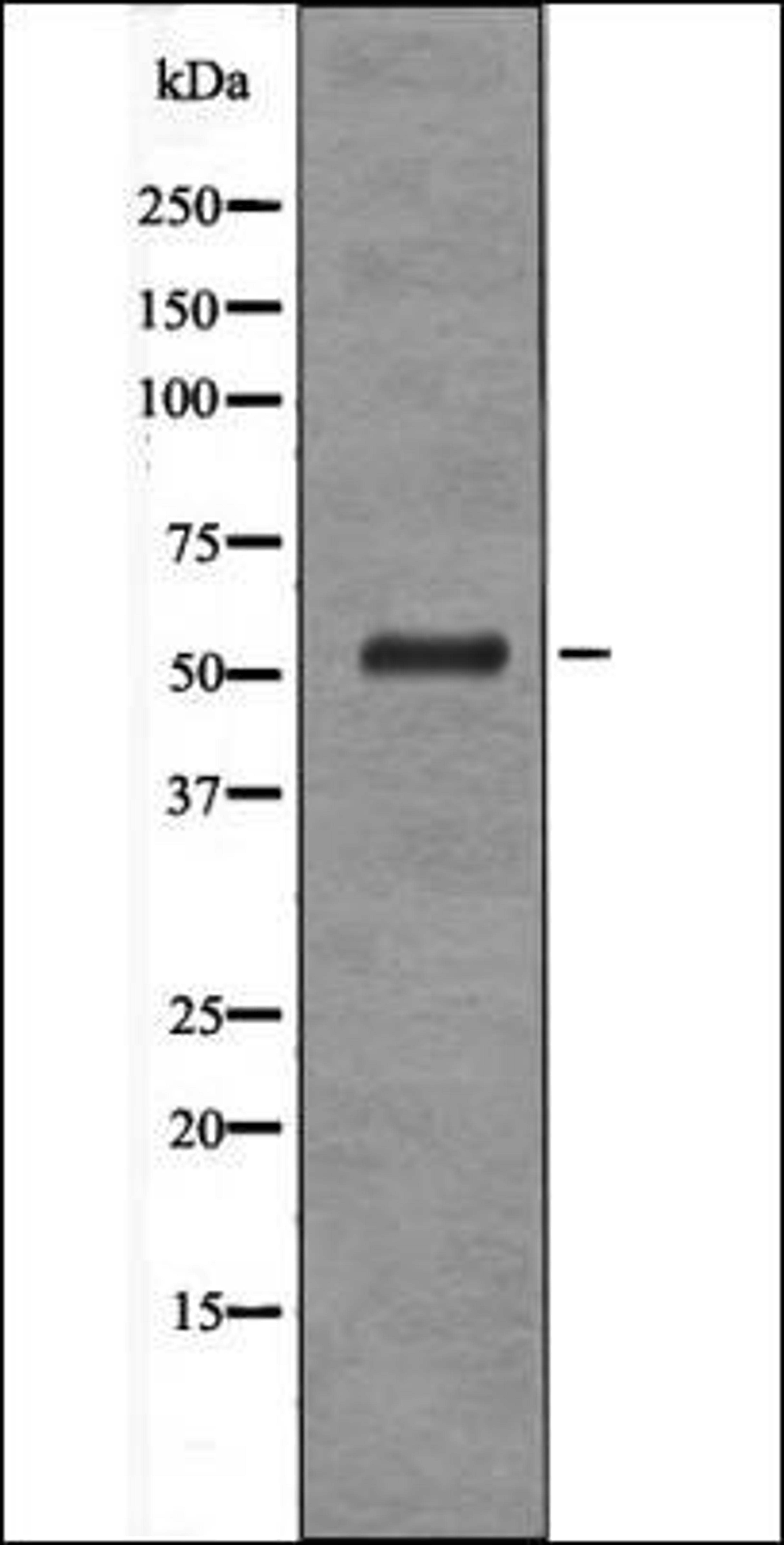 Western blot analysis of UV treated HeLa whole cell lysates using Vimentin -Phospho-Ser39- antibody