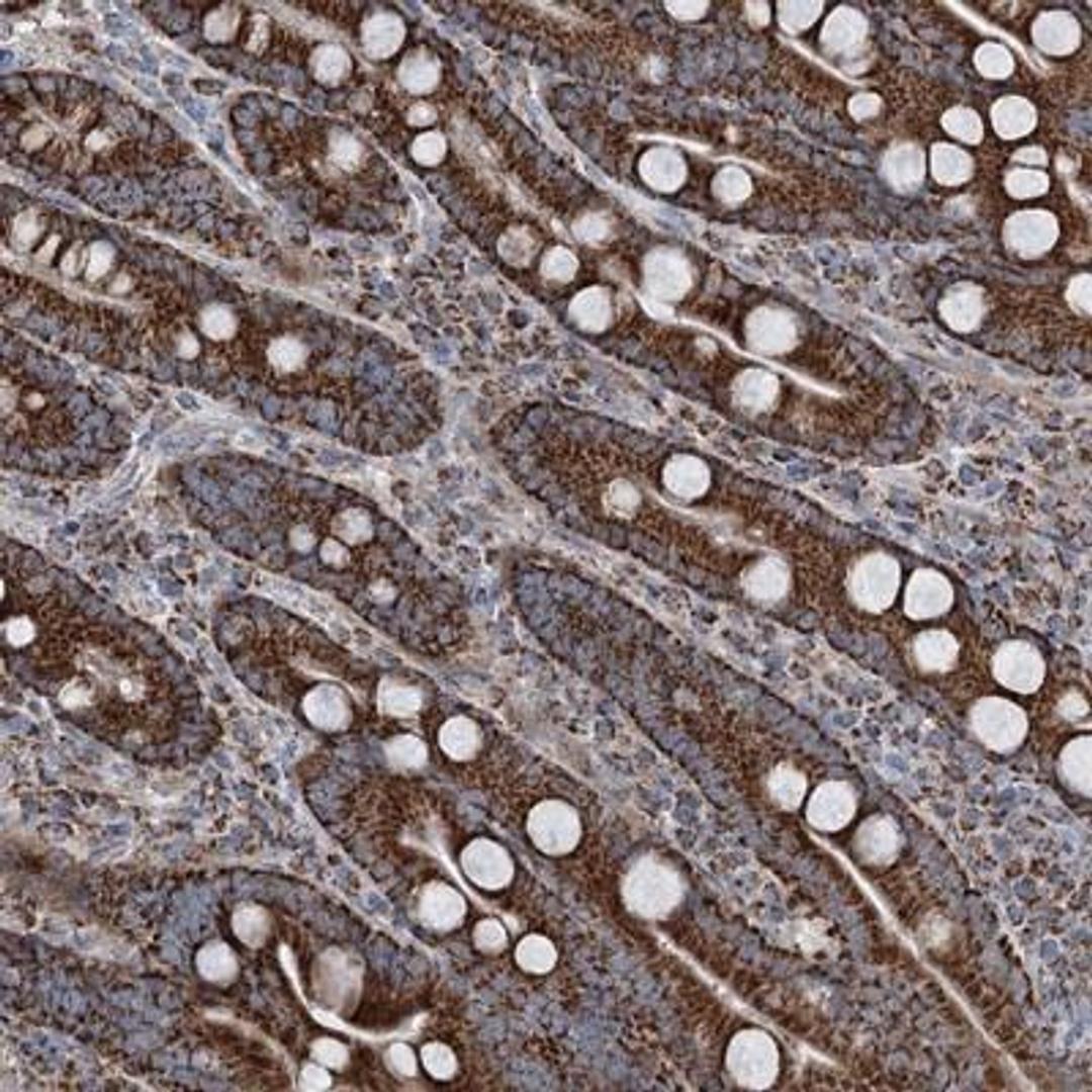 Immunohistochemistry: Urocortin 3 Antibody [NBP1-80732] - Staining of human duodenum shows strong granular cytoplasmic positivity in glandular cells.