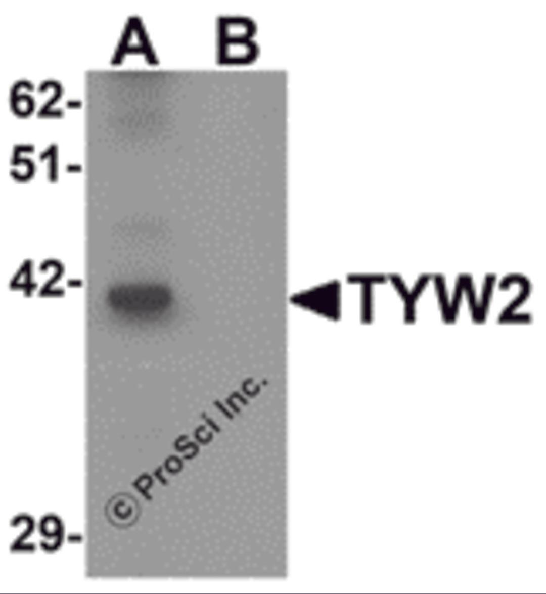 Western blot analysis of TYW2 in K562 cell lysate with TYW2 antibody at 0.5 μg/mL in (A) the absence and (B) the presence of blocking peptide.