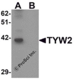 Western blot analysis of TYW2 in K562 cell lysate with TYW2 antibody at 0.5 μg/mL in (A) the absence and (B) the presence of blocking peptide.