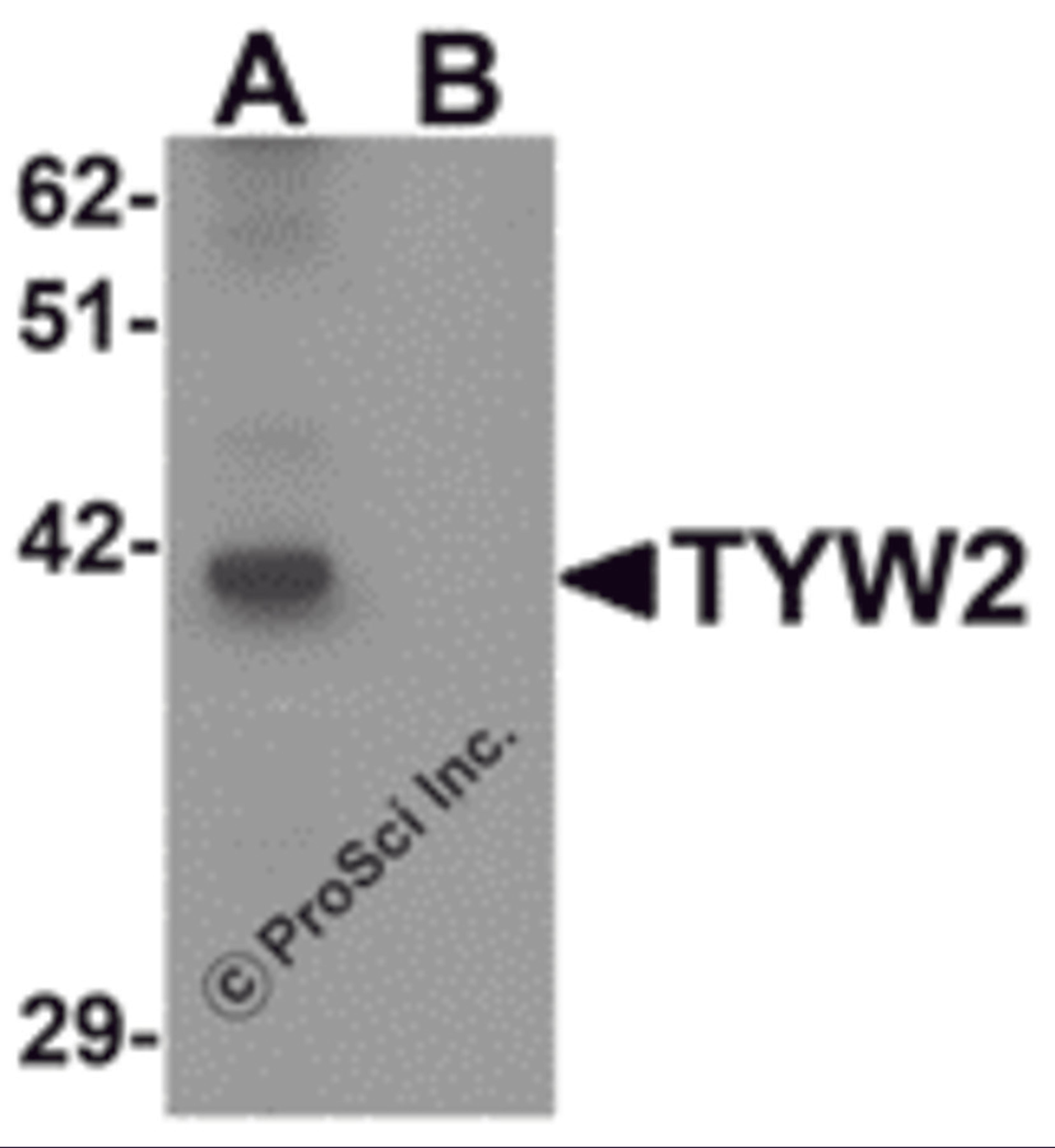 Western blot analysis of TYW2 in K562 cell lysate with TYW2 antibody at 0.5 μg/mL in (A) the absence and (B) the presence of blocking peptide.
