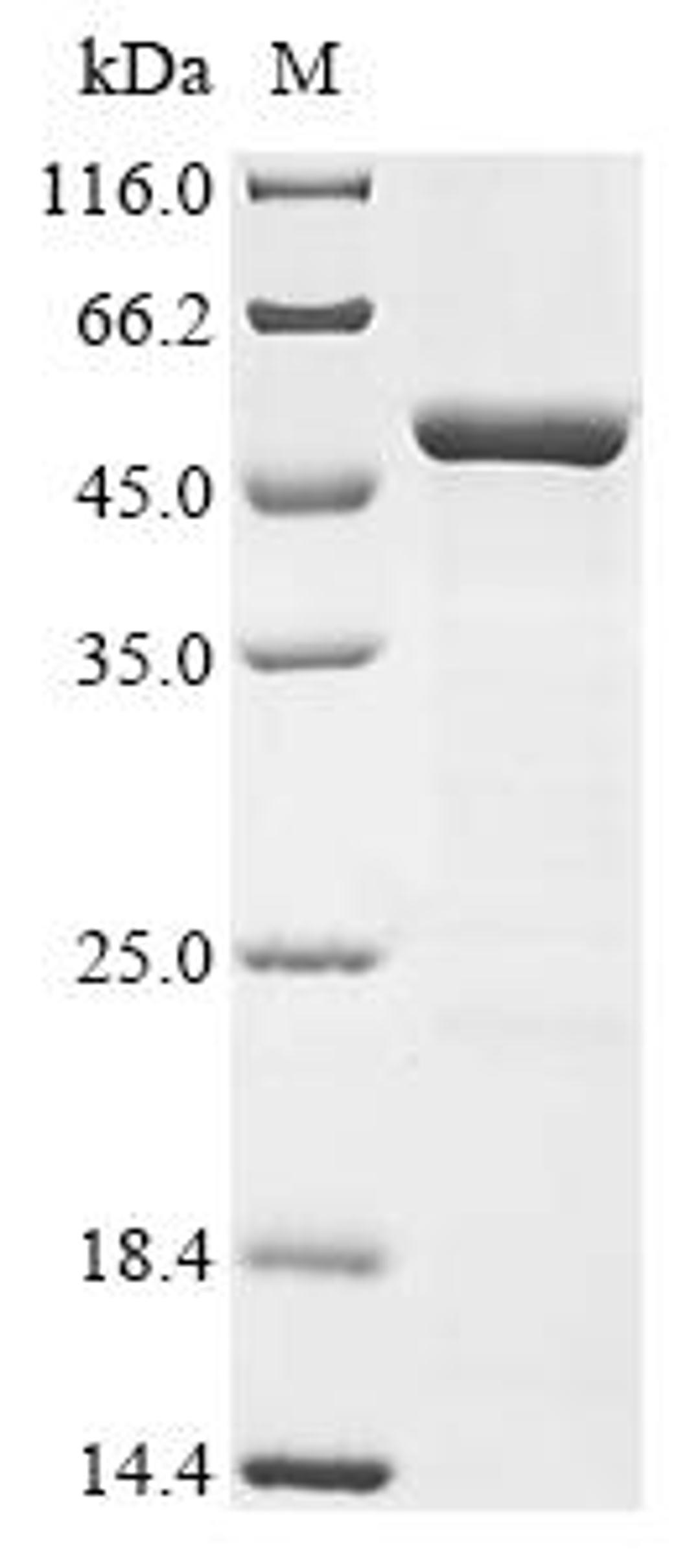 (Tris-Glycine gel) Discontinuous SDS-PAGE (reduced) with 5% enrichment gel and 15% separation gel.