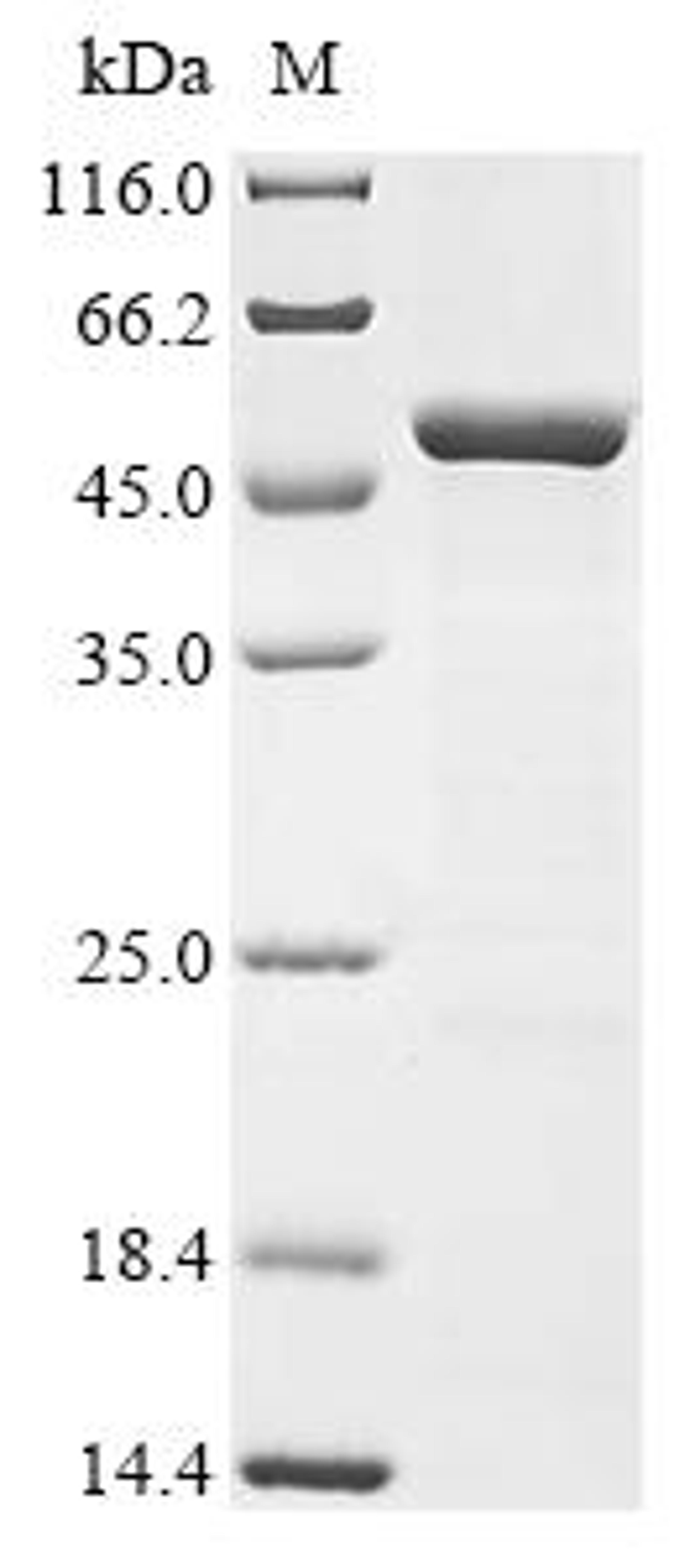 (Tris-Glycine gel) Discontinuous SDS-PAGE (reduced) with 5% enrichment gel and 15% separation gel.