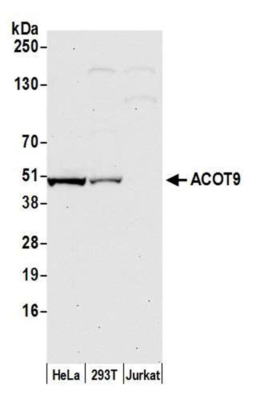 Detection of human ACOT9 by WB.