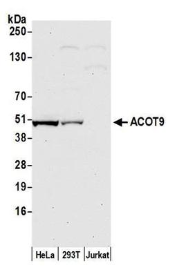 Detection of human ACOT9 by WB.