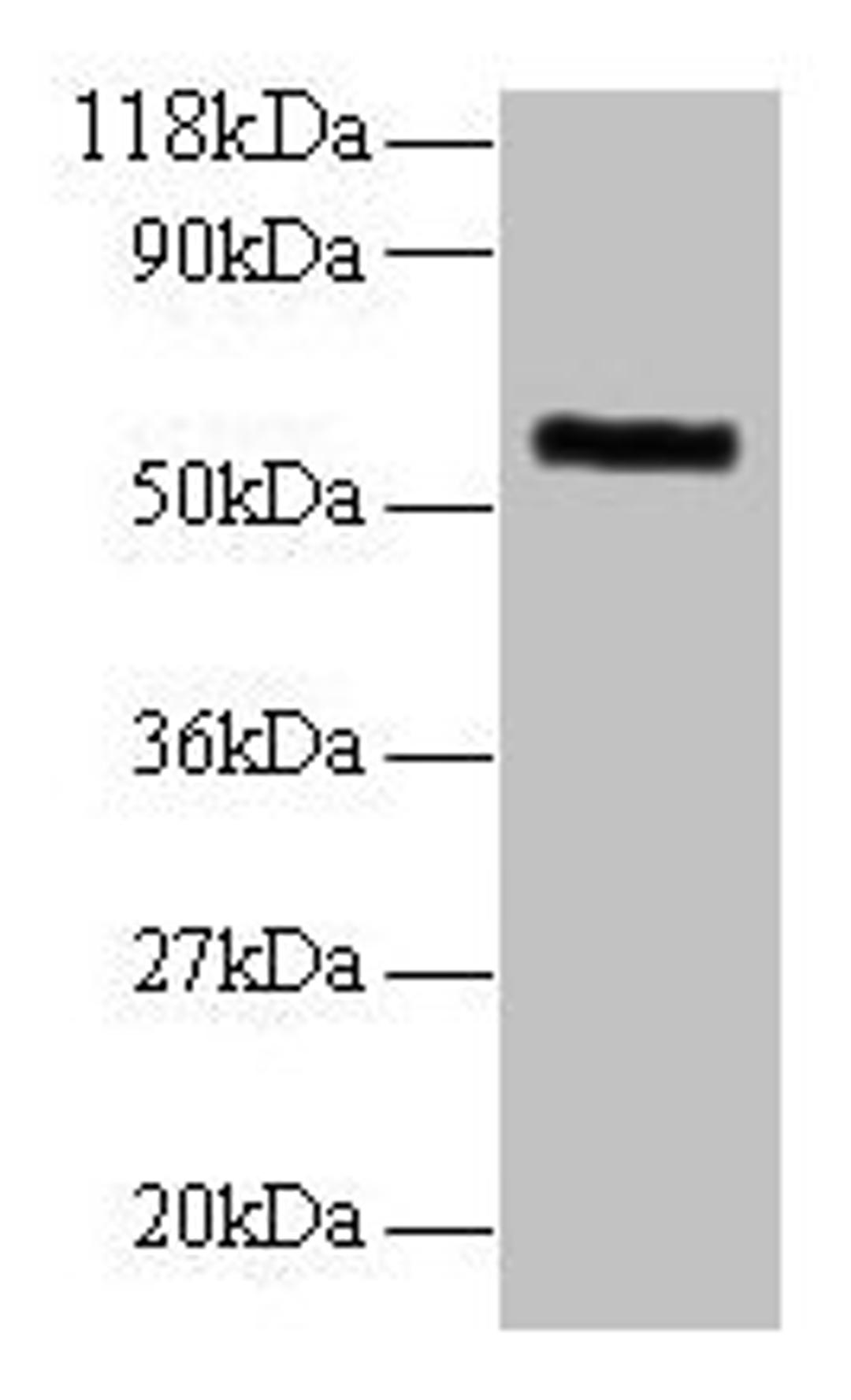Western blot. All lanes: MMP1 antibody at 2µg/ml + 293T whole cell lysate. Secondary. Goat polyclonal to rabbit IgG at 1/10000 dilution. Predicted band size: 55 kDa. Observed band size: 55 kDa
