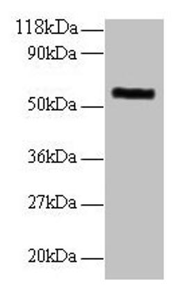 Western blot. All lanes: MMP1 antibody at 2µg/ml + 293T whole cell lysate. Secondary. Goat polyclonal to rabbit IgG at 1/10000 dilution. Predicted band size: 55 kDa. Observed band size: 55 kDa