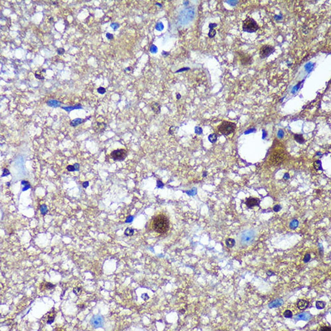 Immunohistochemistry  - TSN Rabbit pAb (A18590)