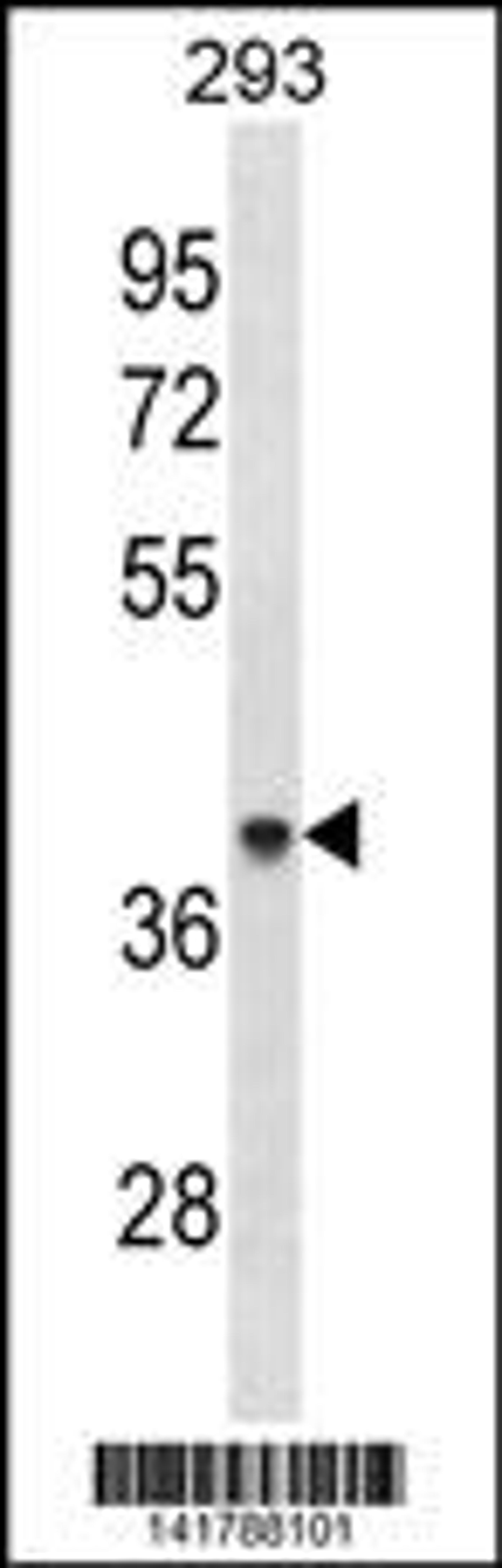 Western blot analysis in 293 cell line lysates (35ug/lane).