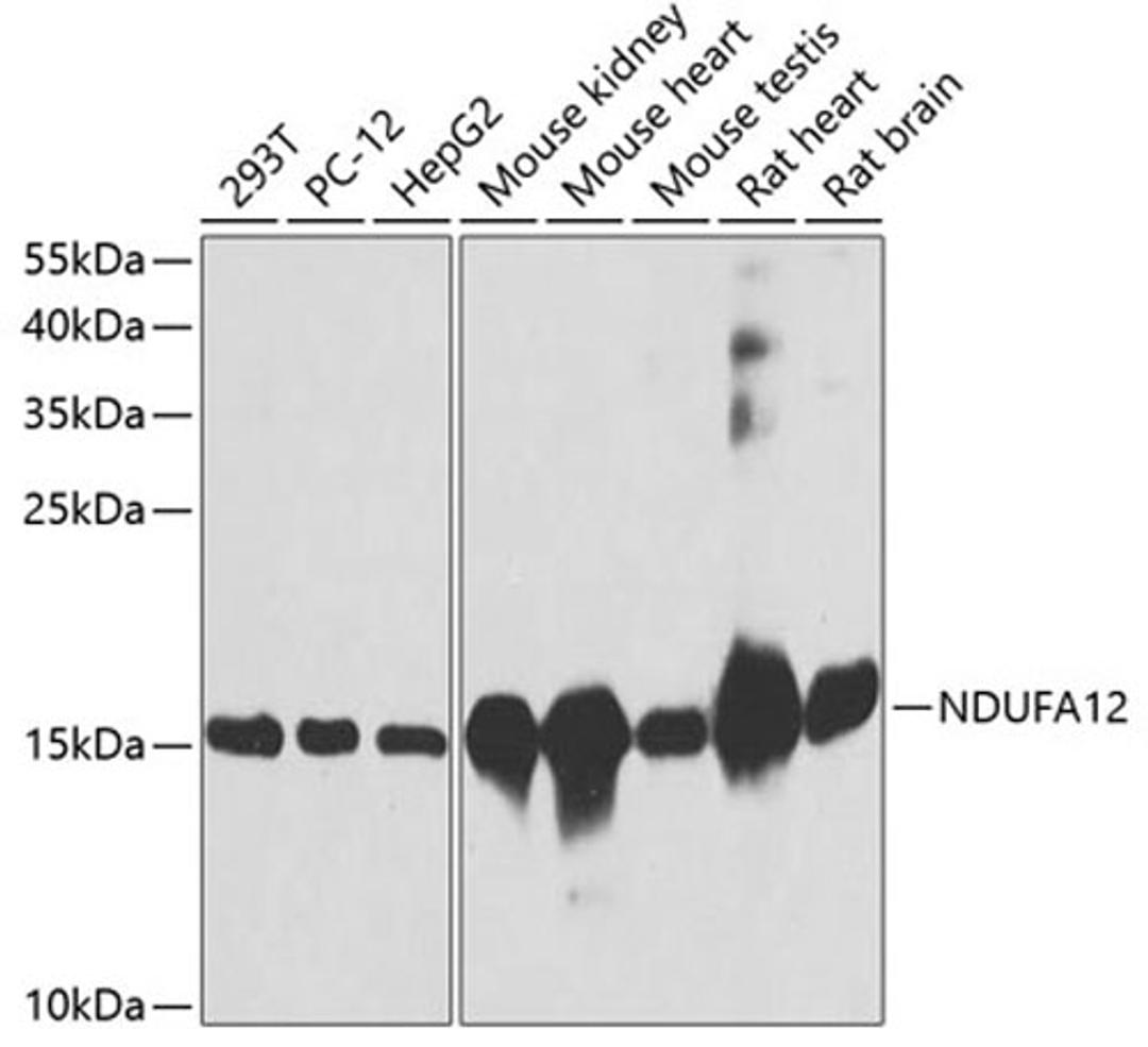 Western blot - NDUFA12 antibody (A8237)