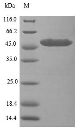 (Tris-Glycine gel) Discontinuous SDS-PAGE (reduced) with 5% enrichment gel and 15% separation gel.