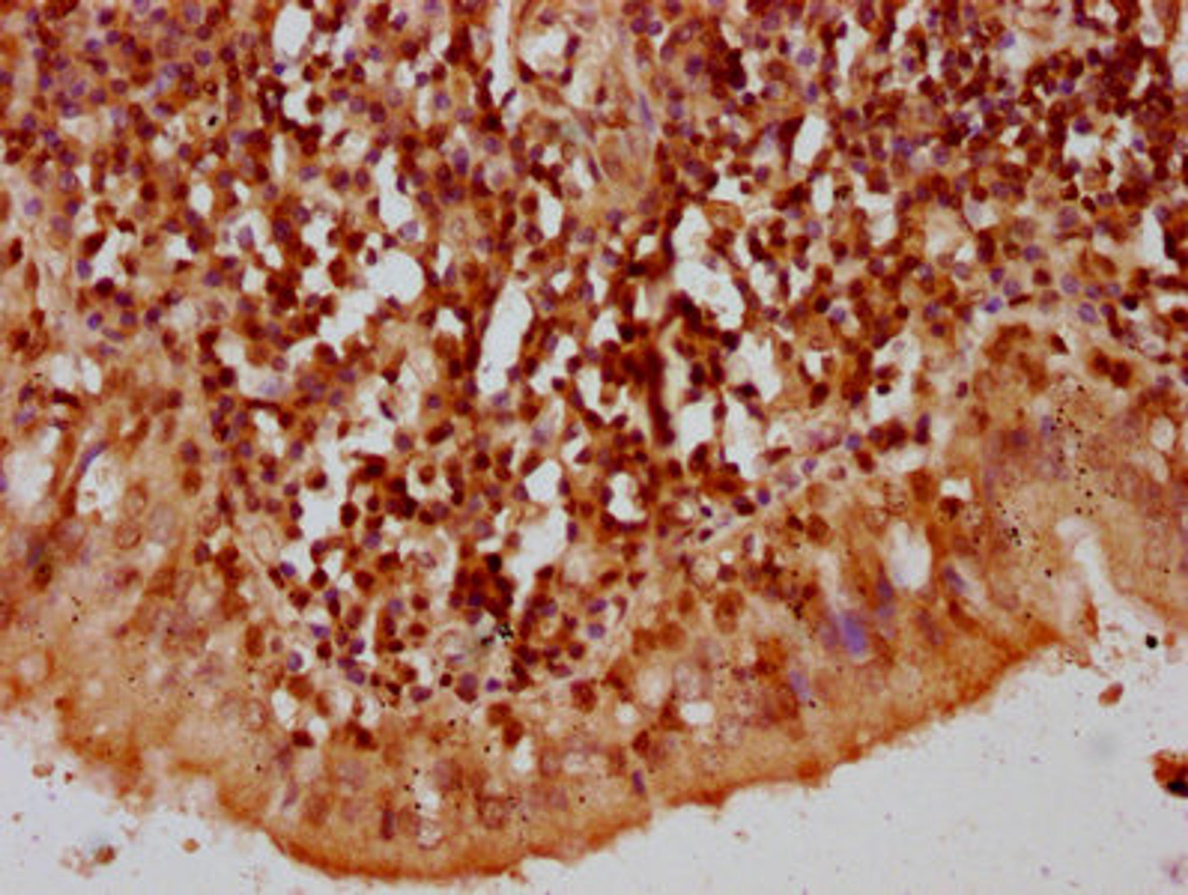 IHC image of CSB-PA010389OA119nbhbHU diluted at 1:10 and staining in paraffin-embedded human lung tissue performed on a Leica BondTM system. After dewaxing and hydration, antigen retrieval was mediated by high pressure in a citrate buffer (pH 6.0). Section was blocked with 10% normal goat serum 30min at RT. Then primary antibody (1% BSA) was incubated at 4&deg;C overnight. The primary is detected by a biotinylated secondary antibody and visualized using an HRP conjugated SP system.