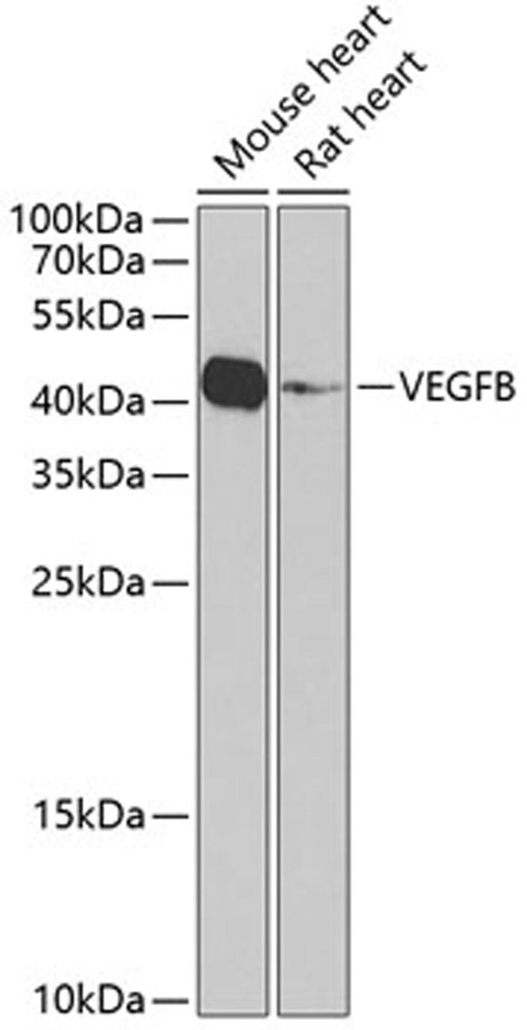 Western blot - VEGFB Antibody (A2132)