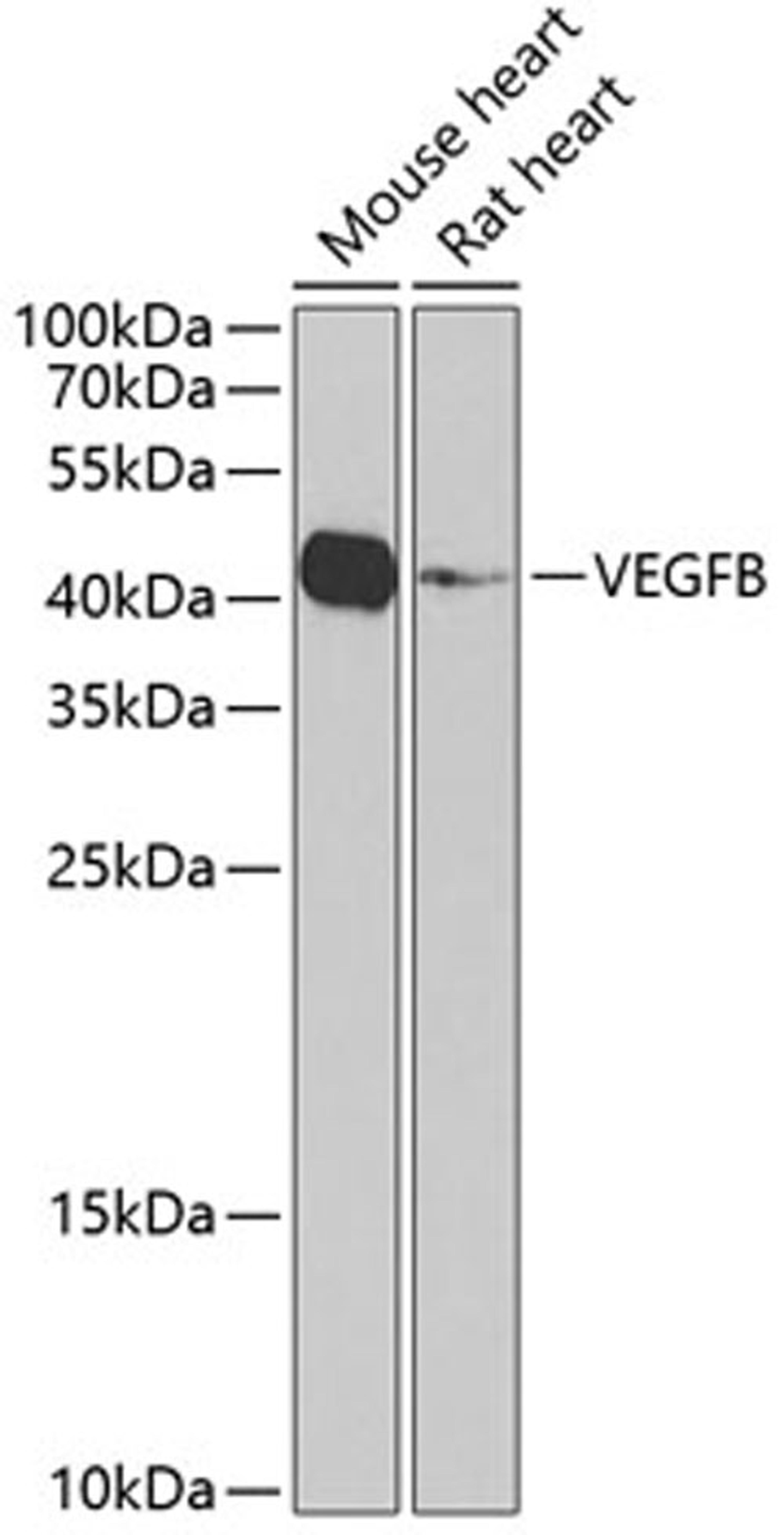 Western blot - VEGFB Antibody (A2132)