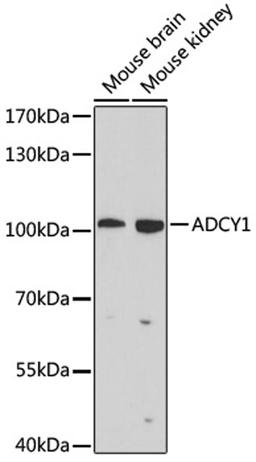 Western blot - ADCY1 antibody (A9760)