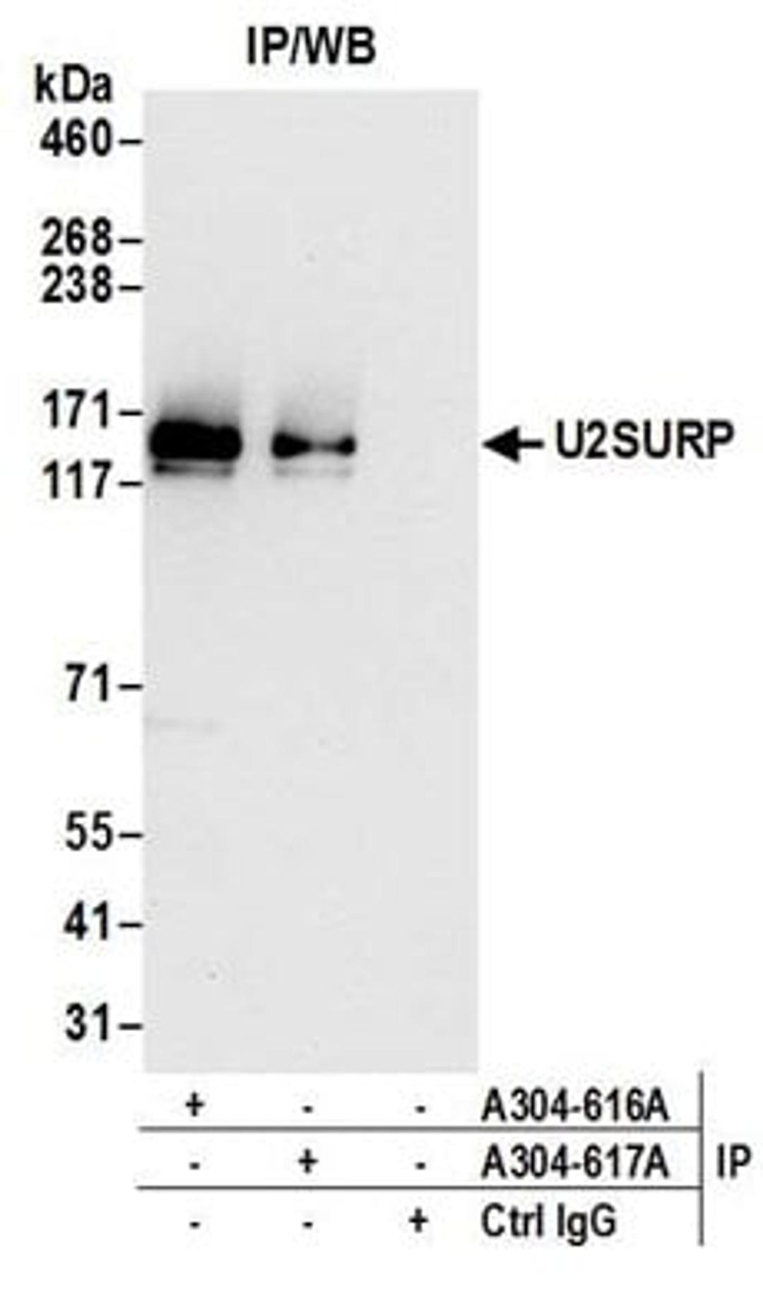 Detection of human U2SURP by western blot of immunoprecipitates.