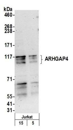 Detection of human ARHGAP4 by western blot.