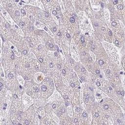 Immunohistochemistry: ZNF627 Antibody [NBP2-31893] - Staining of human stomach, upper shows strong cytoplasmic positivity in glandular cells.