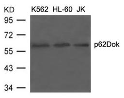 Western Blot: DOK1 Antibody [NB100-82111] - Analysis of extracts from K562, HL-60 and JK cells using p62Dok (Ab-398) antibody