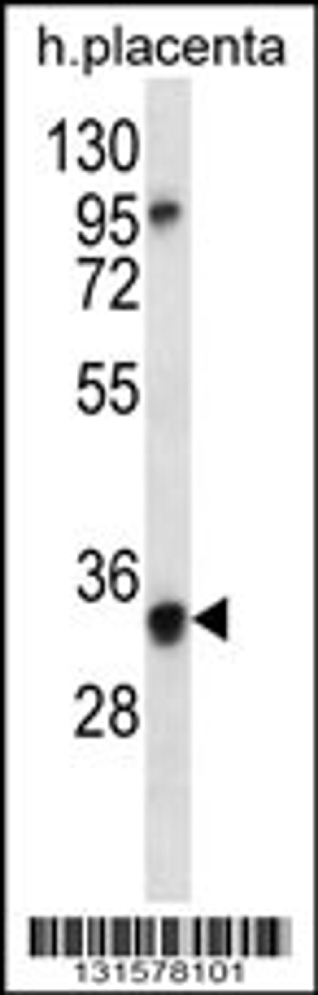 Western blot analysis in human placenta tissue lysates (35ug/lane).