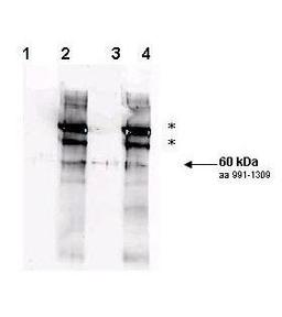 Western blot analysis of Lane 1 - non-phosphorylated wild type yeast Rad9, Lane 2 - in vitro phosphorylated wild type yeast Rad9, Lane 3 - non-phosphorylated S1129A/S1260A double mutant Rad9, Lane 4 - in vitro phosphorylated S1129A/S1260A double mutant us