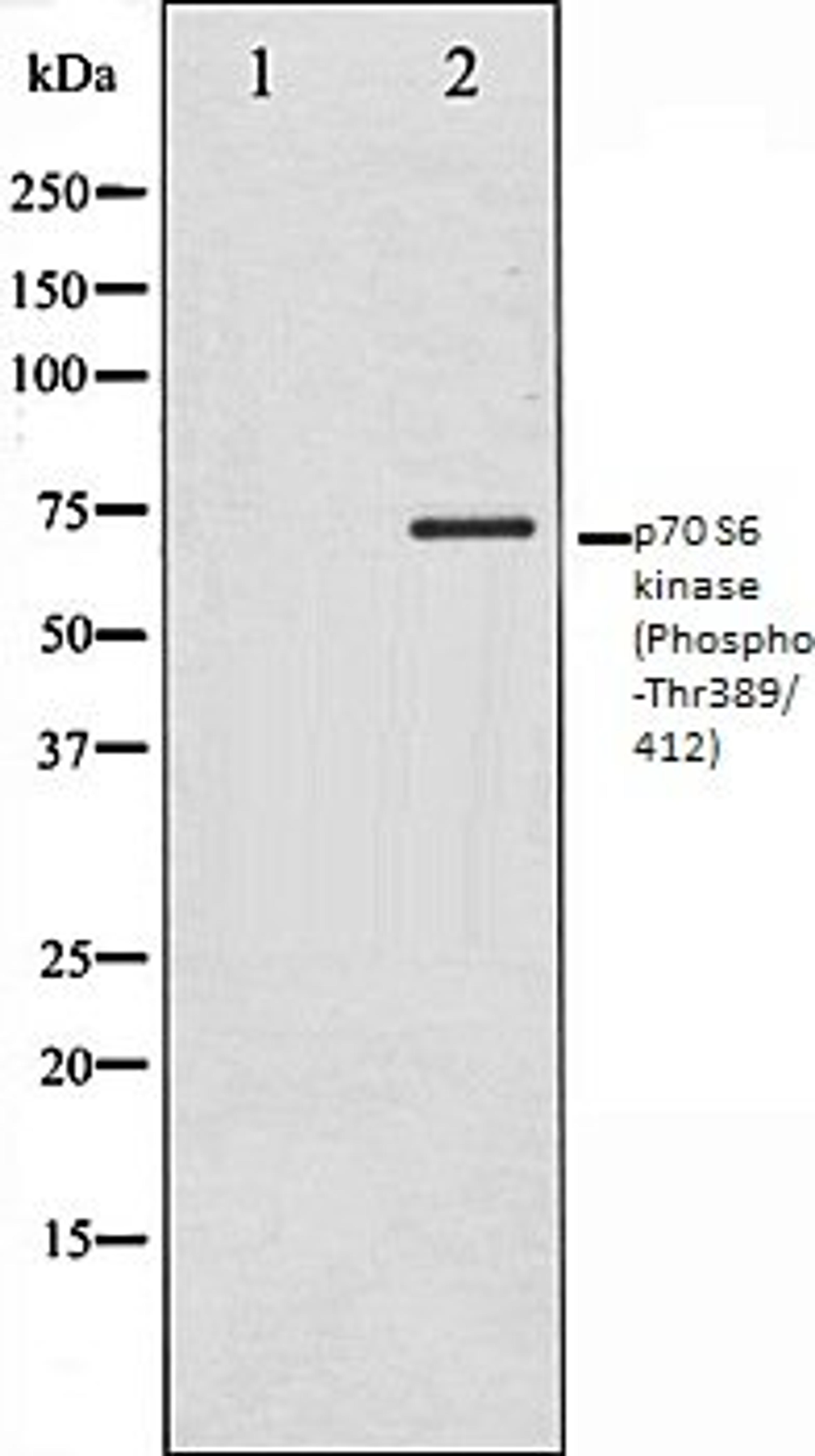 Western blot analysis of Jurkat whole cell lysates using p70 S6 Kinase (Phospho-Thr389/412) antibody, The lane on the left is treated with the antigen-specific peptide.