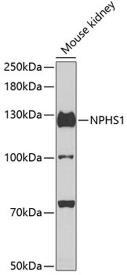 Western blot - NPHS1 antibody (A3048)